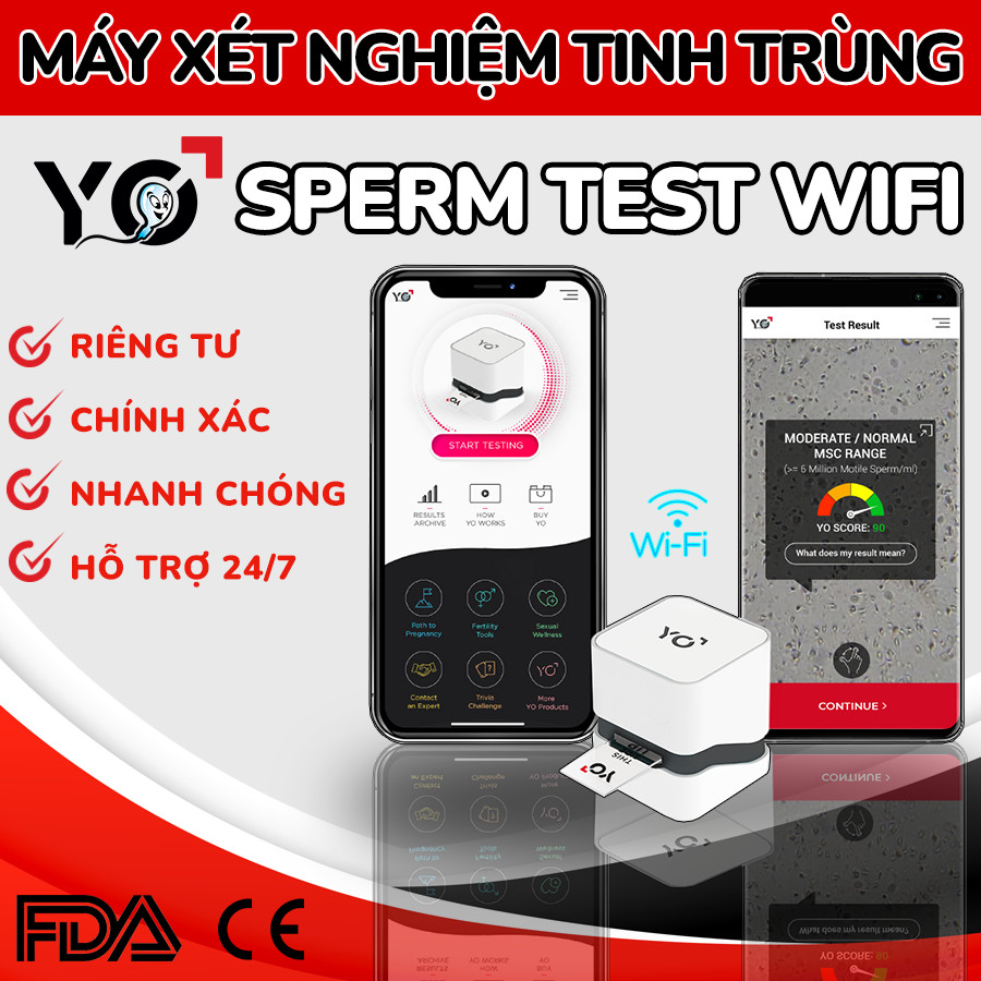 Yo Sperm Test - giúp nam giới chủ động xét nghiệm tinh dịch đồ ngay tại nhà