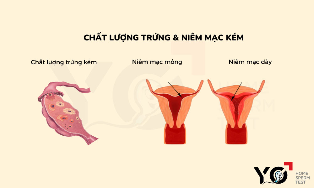Chất lượng trứng và niêm mạc kém khiến khó có thai