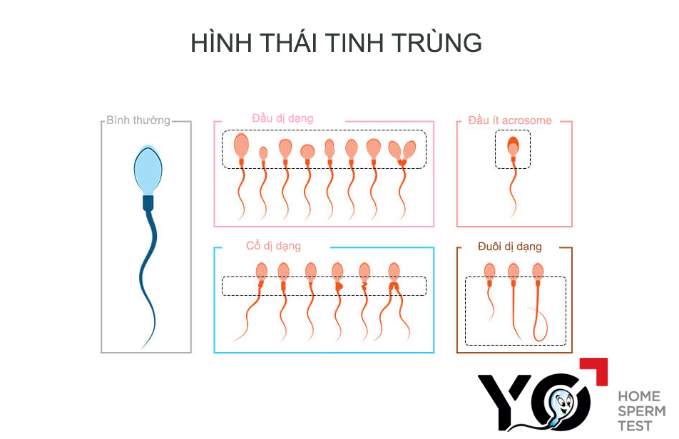 Hình ảnh tinh trùng bình thường và dị dạng