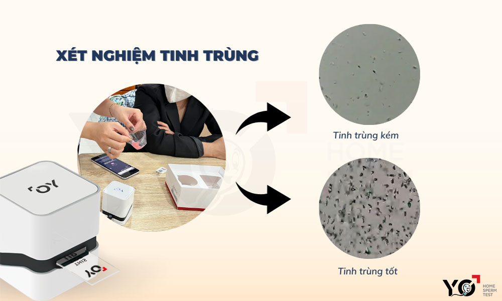 Kiểm tra chất lượng tinh trùng ngay tại nhà