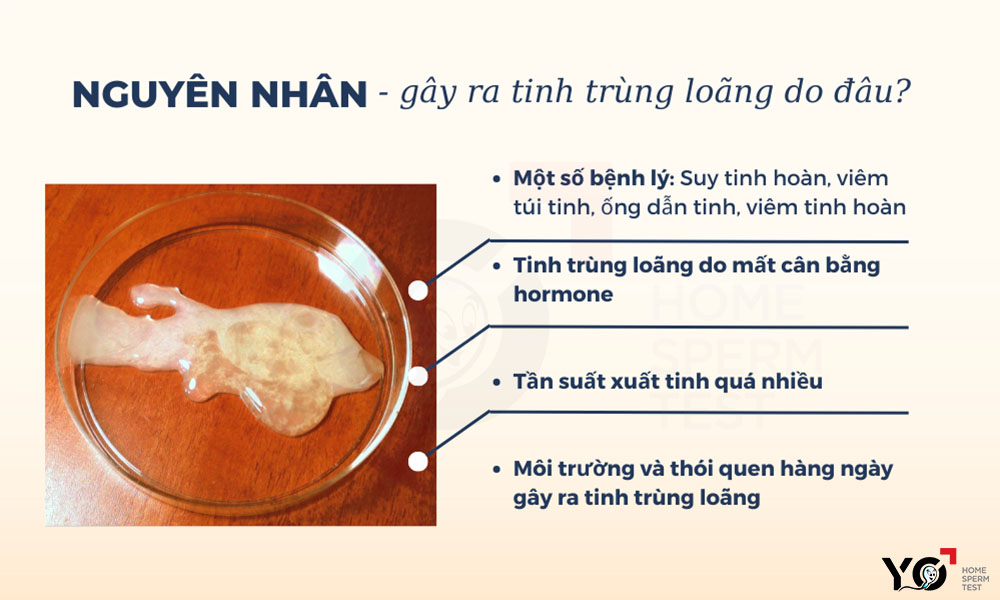 Nguyên nhân gây ra tinh trùng loãng là do đâu?