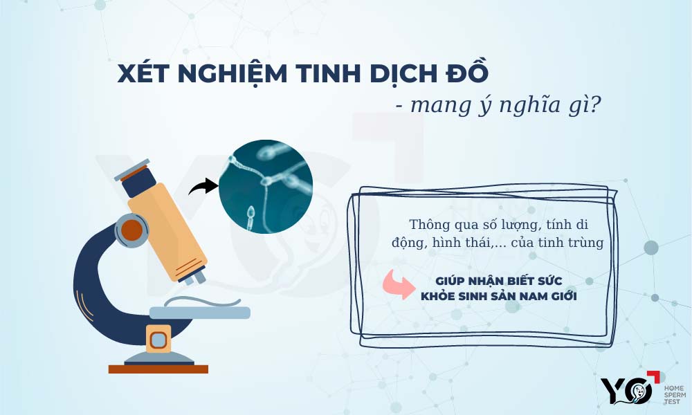Xét nghiệm tinh dịch đồ là như thế nào?