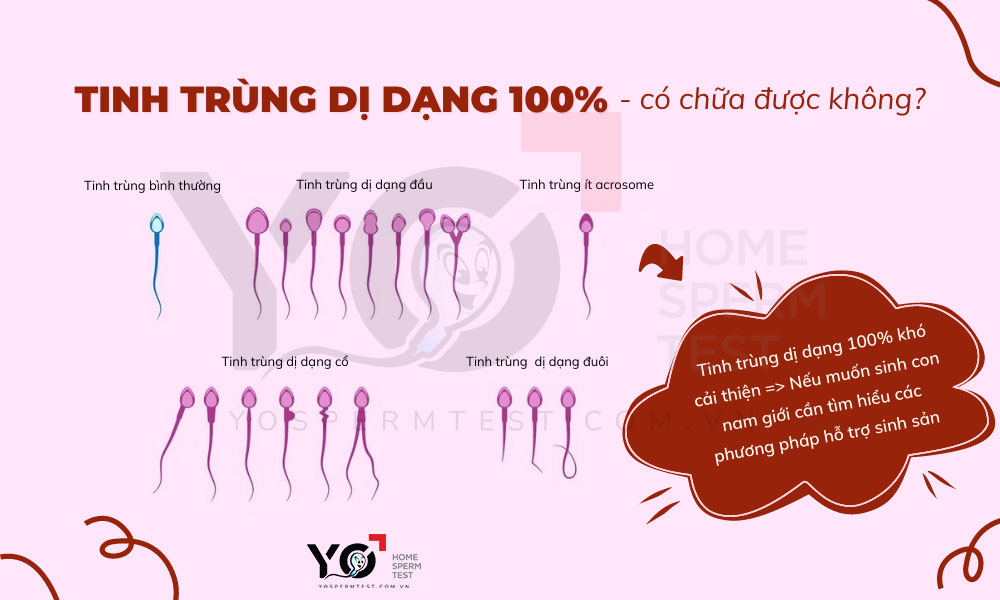 Tinh trùng dị dạng 100% có chữa được không?