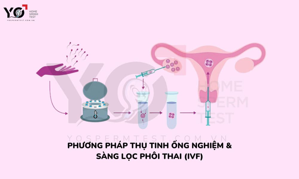 Thực hiện thụ tinh trong ống nghiệm giúp sàng lọc phôi tốt
