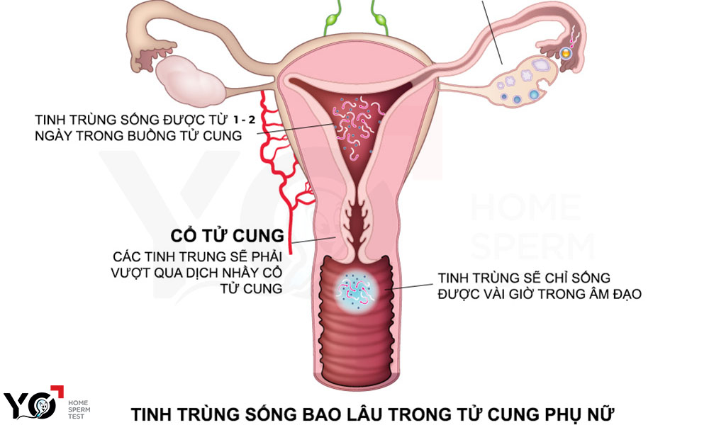 Tinh trùng Y có thể sống được từ 1 - 2 ngày trong tử cung nữ giới