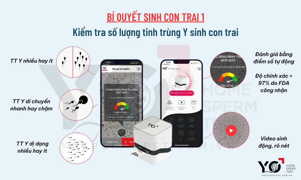 Kiểm tra chất lượng tinh trùng Y