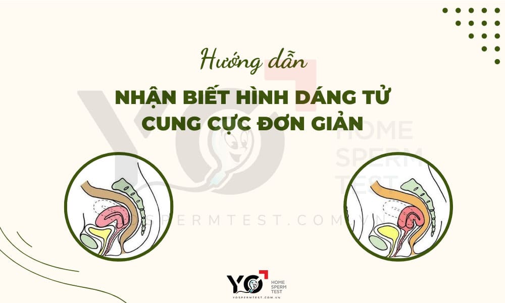 Dựa vào hình dáng tử cung để có tư thế quan hệ phù hợp sinh con gái