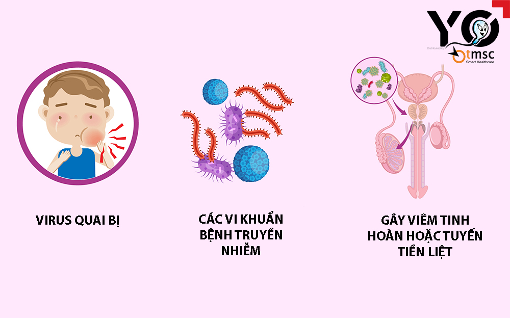 Viêm nhiễm nam khoa khiến tinh dịch có mùi hôi khó chịu
