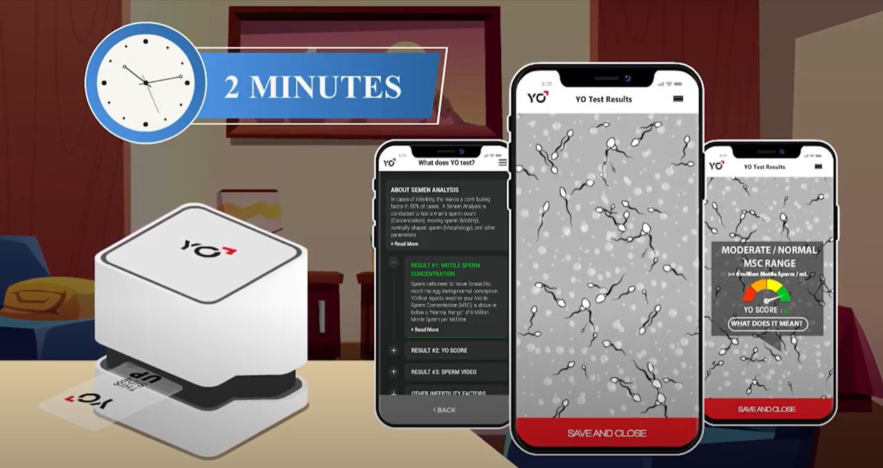 Sử dụng Yo Sperm kiểm tra được số lượng, sức khỏe di động , hình thái của tinh trùng
