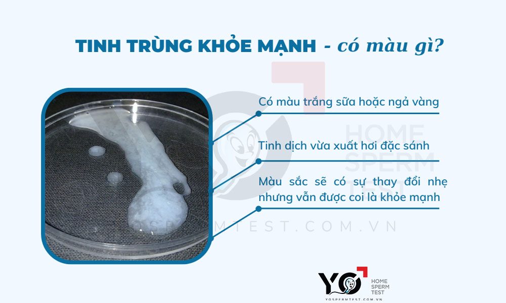 Tinh trùng khỏe mạnh có màu trắng sữa hoặc hơi ngả vàng