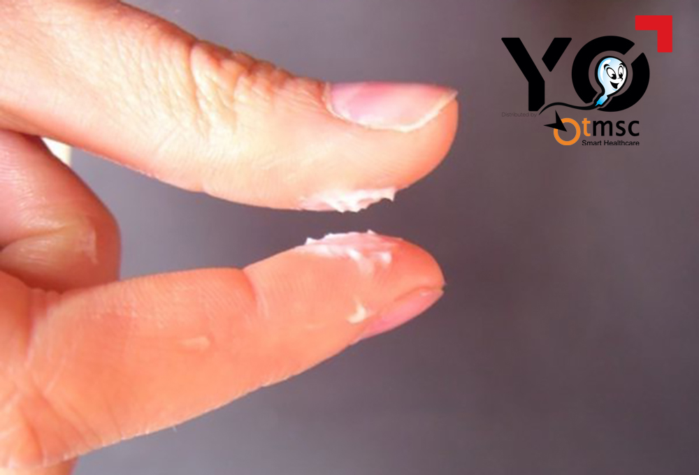 Tinh trùng vón cục như hạt gạo
