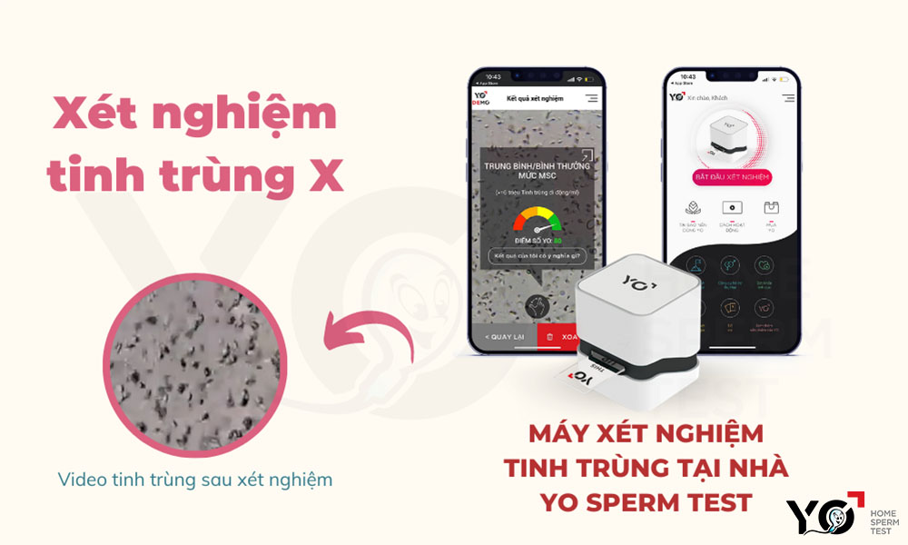 Xét nghiệm tinh trùng X