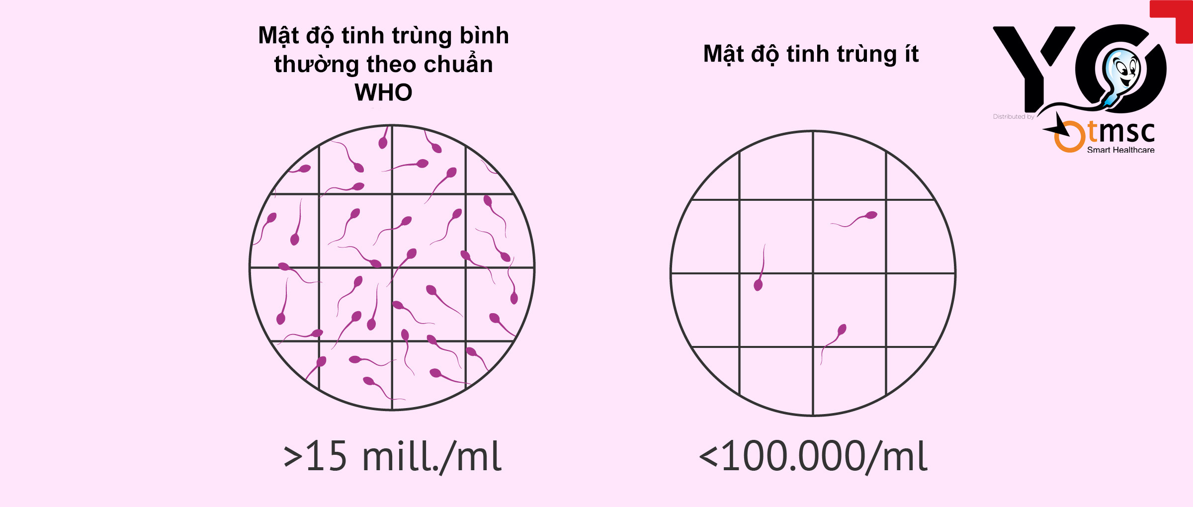Số lượng tinh trùng di động sẽ được thể hiện qua kết quả xét nghiệm tinh trùng