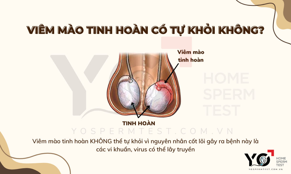 Viêm mào tinh hoàn không thể tự khỏi