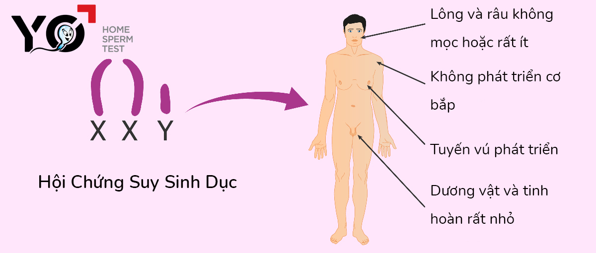 Hội chứng suy sinh dục