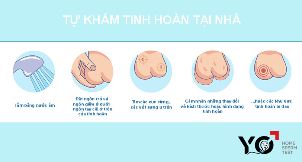 Tự kiểm tra lâm sàng tinh hoàn