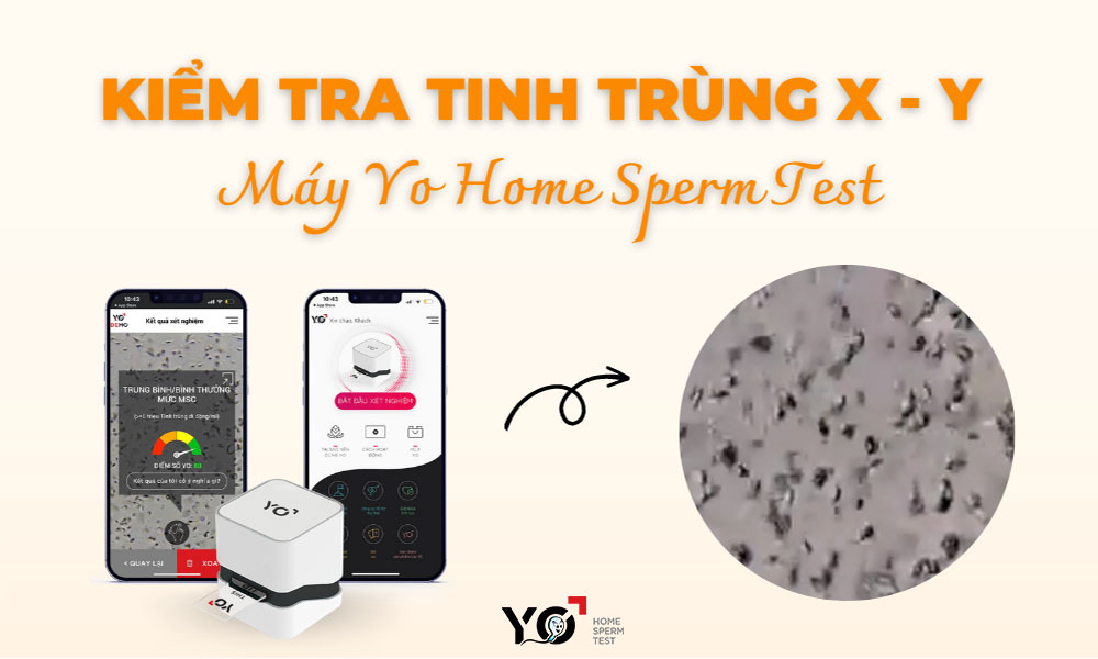 Kiểm tra tỷ lệ tinh trùng XY cùng máy Yo