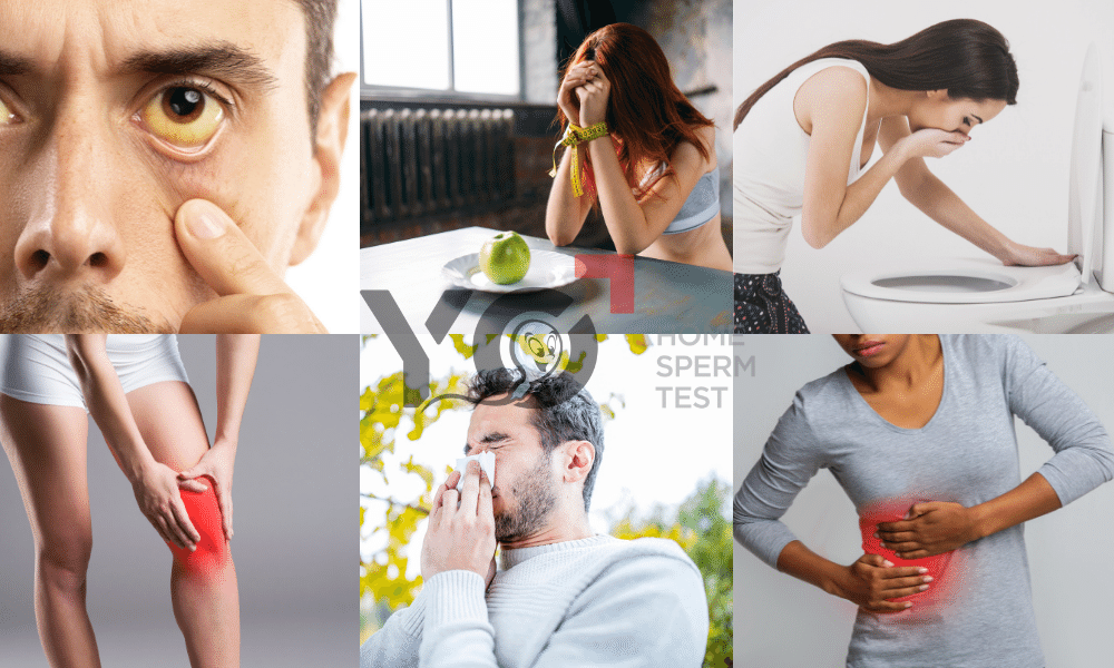 Một số biểu hiện của bệnh nhân nhiễm viêm gan B