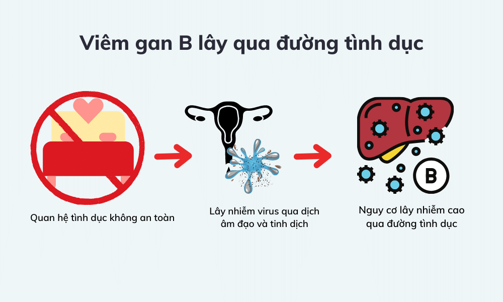 Bệnh viêm gan B lây truyền qua đường tình dục