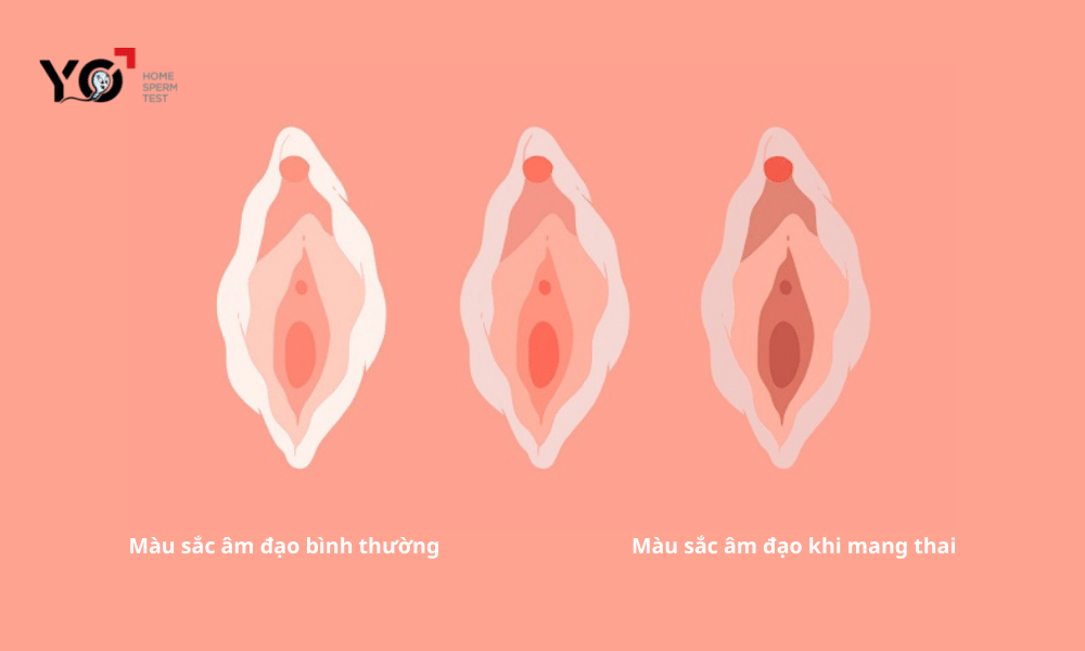 Màu sắc âm đạo thay đổi thể hiện bạn đã có tin vui