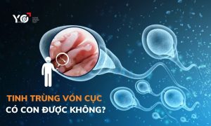 tinh trung von cuc co con duoc khong