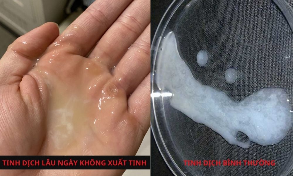 Tinh dịch sau lần xuất tinh có màu ngả vàng, lượng nhiều là biểu hiện cho thấy đàn ông lâu ngày không quan hệ