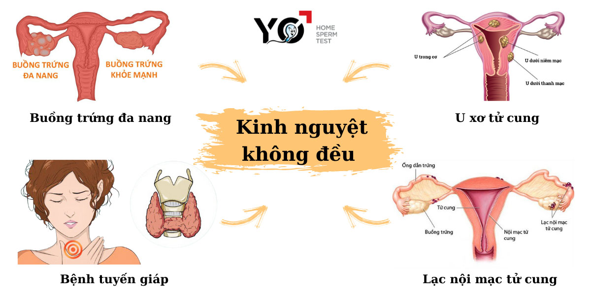 Một số bệnh lý gây rối loạn kinh nguyệt cho nữ giới