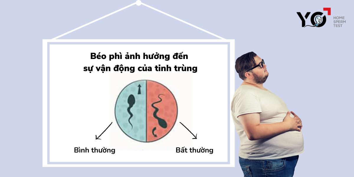 Béo phì ảnh hưởng đến sự vận động của tinh trùng