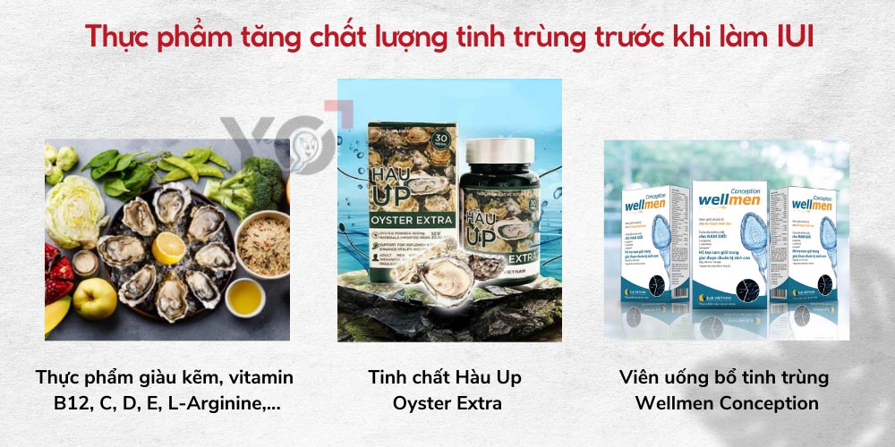 Nam giới cần chú ý tăng chất lượng tinh trùng trước khi làm IUI