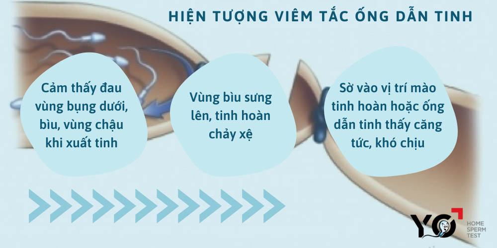 Uống nhiều rượu làm viêm tắc ống dẫn tinh và có thể dẫn đến vô sinh