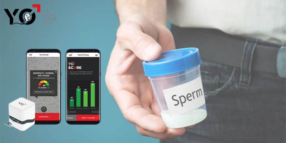 Xét nghiệm tinh dịch đồ ngay tại nhà với Yo Sperm Test sau khi mắc Covid-19