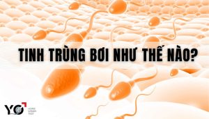 Tinh trùng bơi như thế nào?