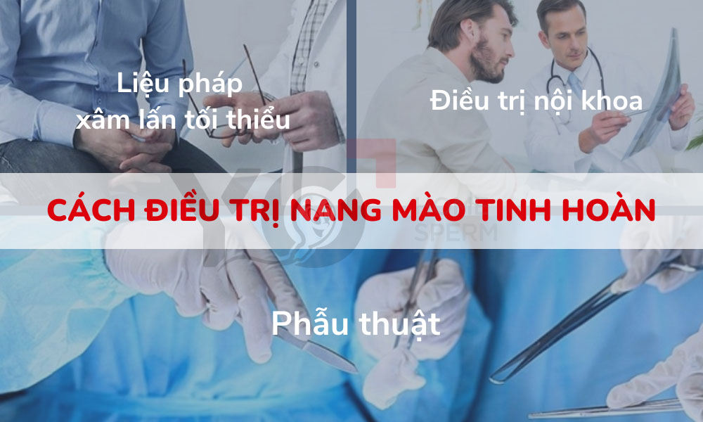 Nang mào tinh hoàn chữa trị như thế nào?