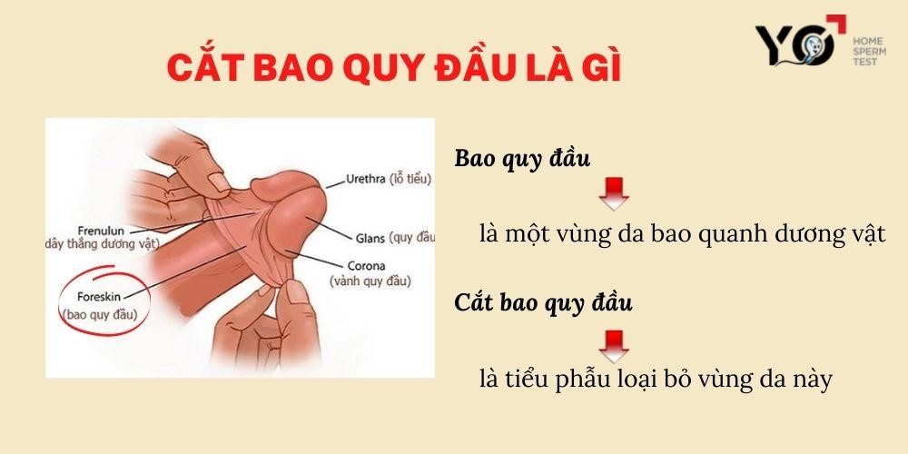Cắt bao quy đầu là gì?