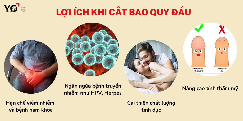 Cắt bao quy đầu có tác dụng gì?