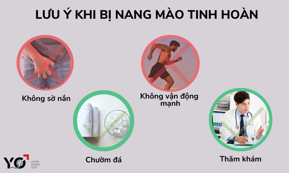 Một số lưu ý để nang mào tinh hoàn không phát triển