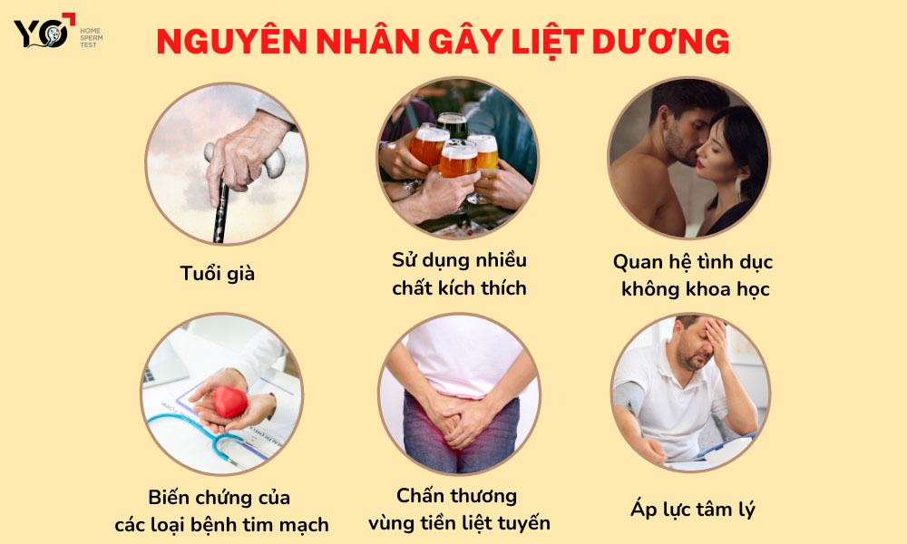 Một số nguyên nhân chủ yếu gây liệt dương