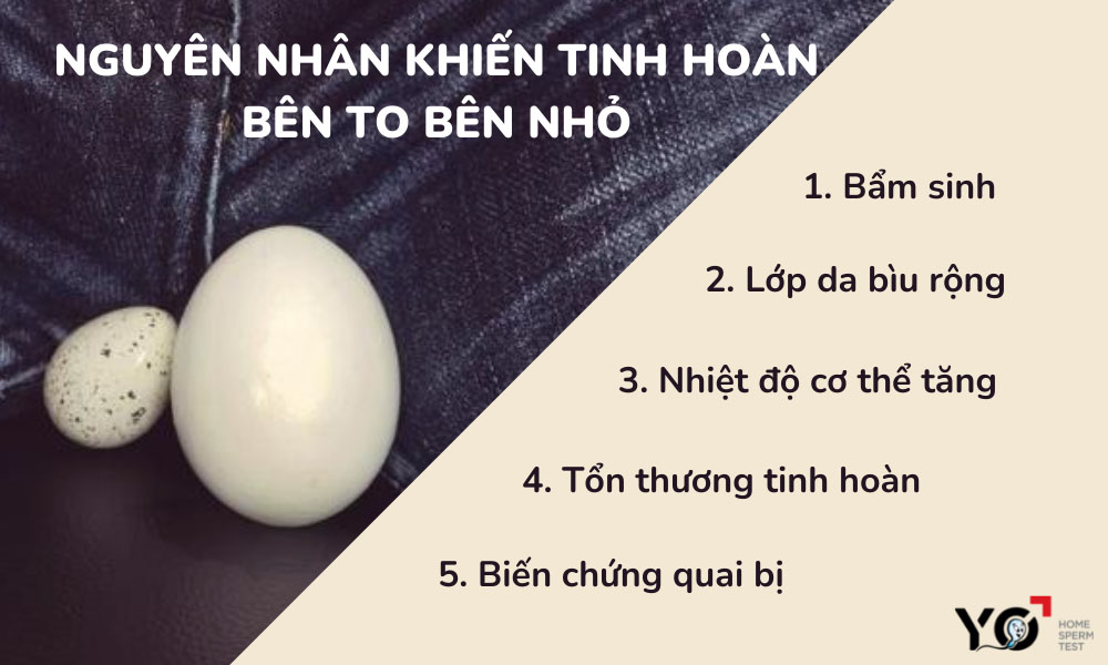 Nguyên nhân chủ yếu khiến tinh hoàn bên to bên nhỏ