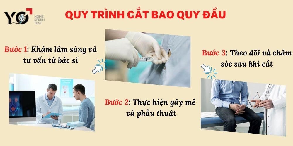 Quy trình cắt bao quy đầu gồm 3 bước 