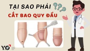 Tại sao phải cắt bao quy đầu?