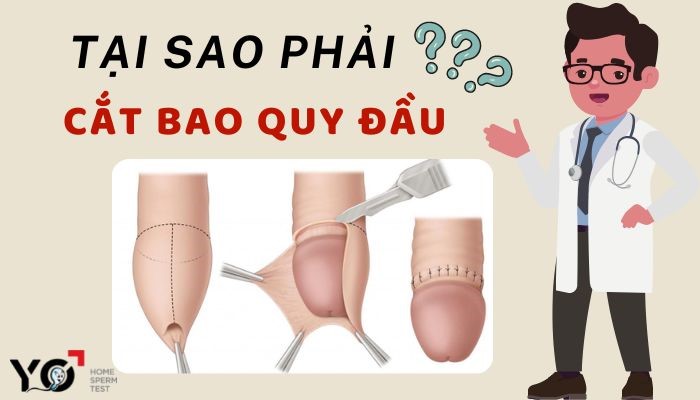 Tại sao phải cắt bao quy đầu?