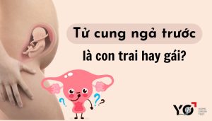 Tử cung ngả trước là con trai hay gái?