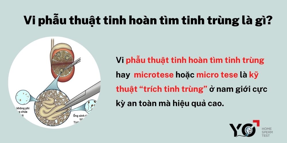 Vi phẫu thuật tinh hoàn tìm tinh trùng là gì?
