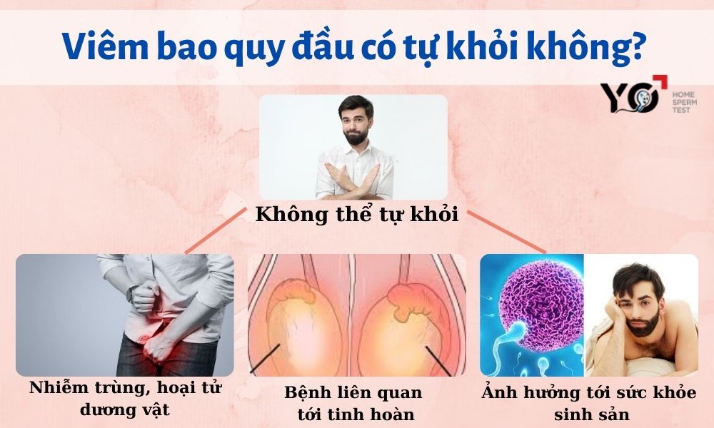 Viêm bao quy đầu sẽ dẫn tới nếu không điều trị