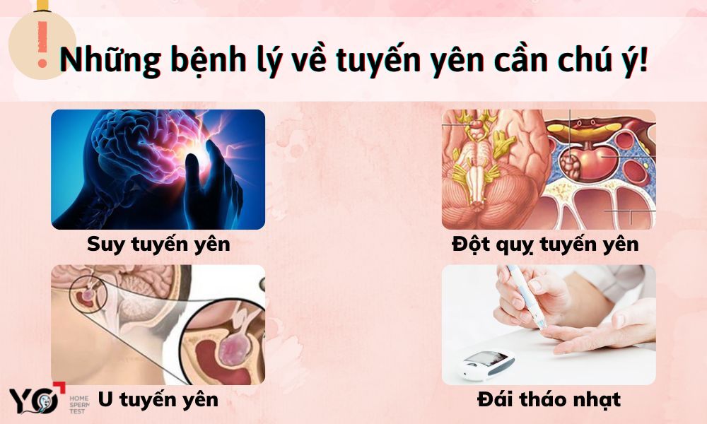 Những bệnh lý liên quan tới tuyến yên