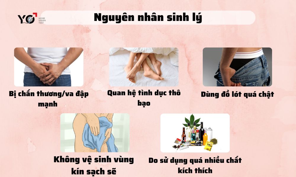 Nguyên nhân sinh lý của hiện tượng đau tức tinh hoàn nhưng không sưng