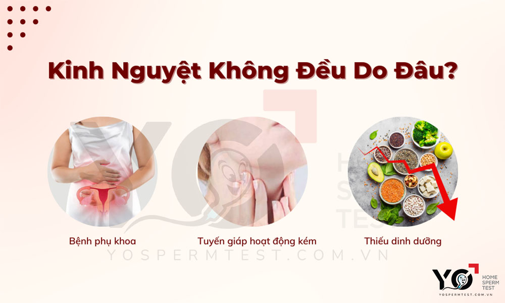 Nguyên nhân gây ra kinh nguyệt không đều là gì?