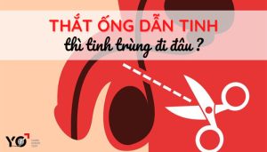 Thắt ống dẫn tinh thì tinh trùng đi đâu