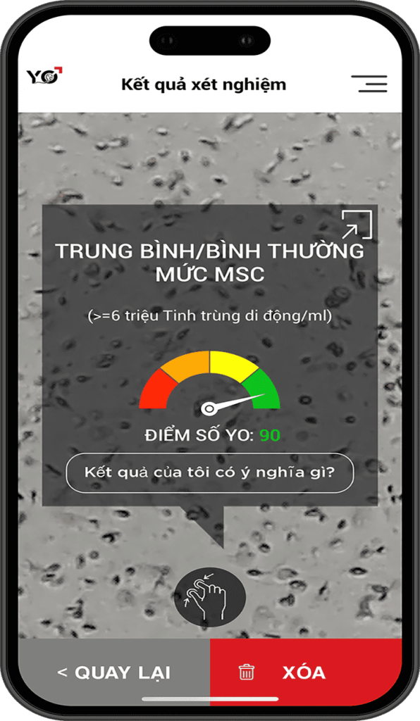 video ket qua tinh trung iphone