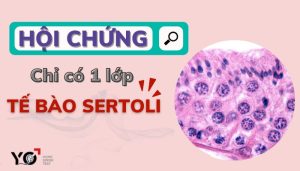 Hoi chung chi co mot lop te bao sertoli
